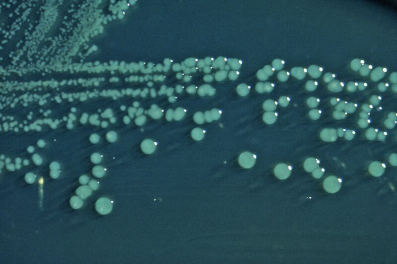 ملف:Shigella boydii 01.jpg