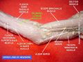 Palmaris longus muscle