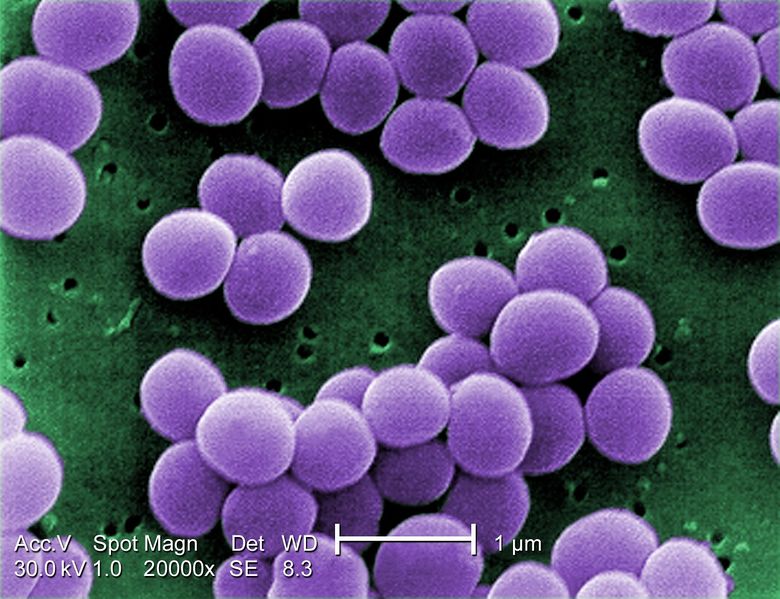 ملف:Staphylococcus aureus VISA 2.jpg