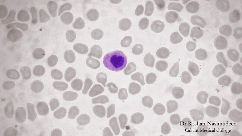 ملف:Neutrophil 1.jpg