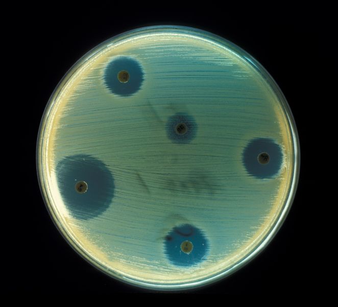 ملف:Staphylococcus aureus.jpg